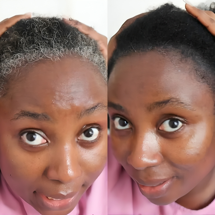 Botanica Paris™ : Bye Bye Cheveux Blancs