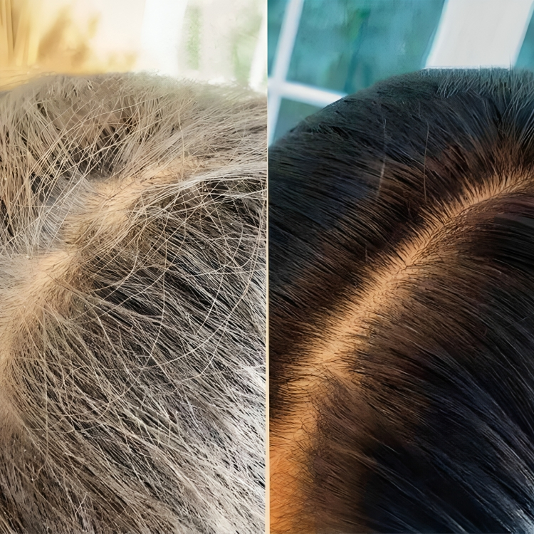 Botanica Paris™ : Bye Bye Cheveux Blancs